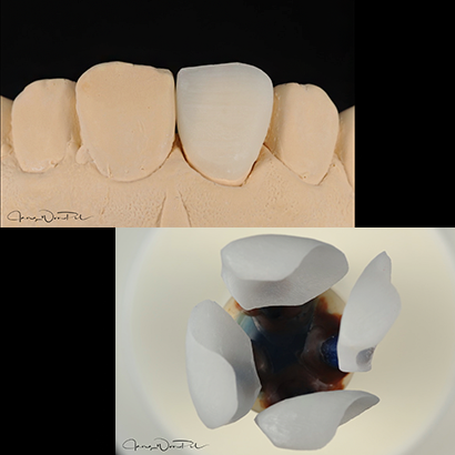 Case 1
