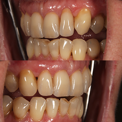 Case 2   
Final Result