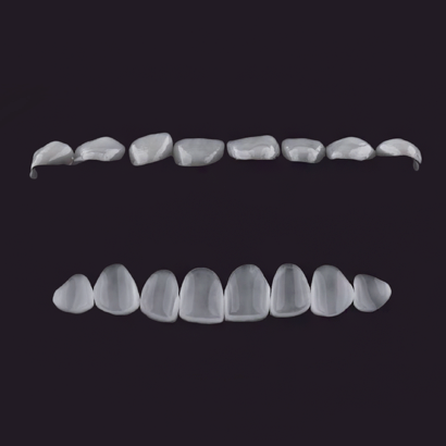 Case 4
Discoloration of the Anterior Maxilla