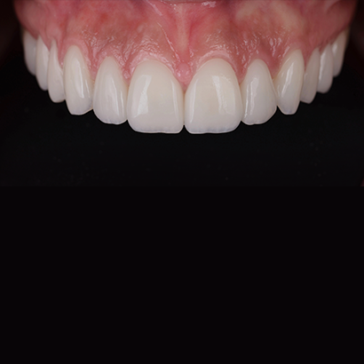 Case 1