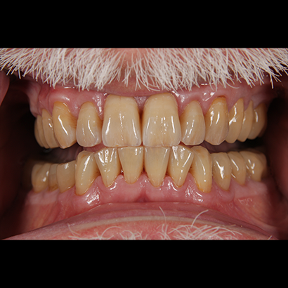 Case 1   
Final Result