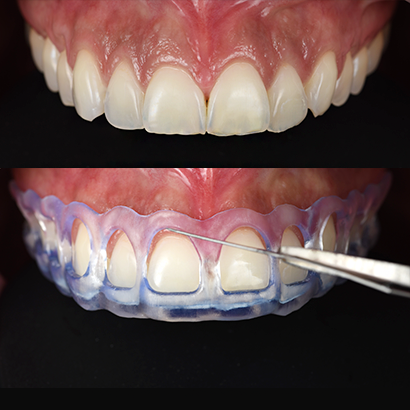 Case 1