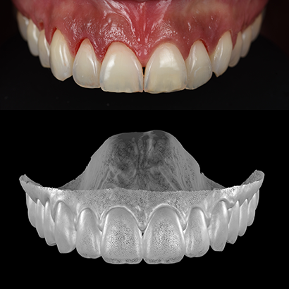 Case 1