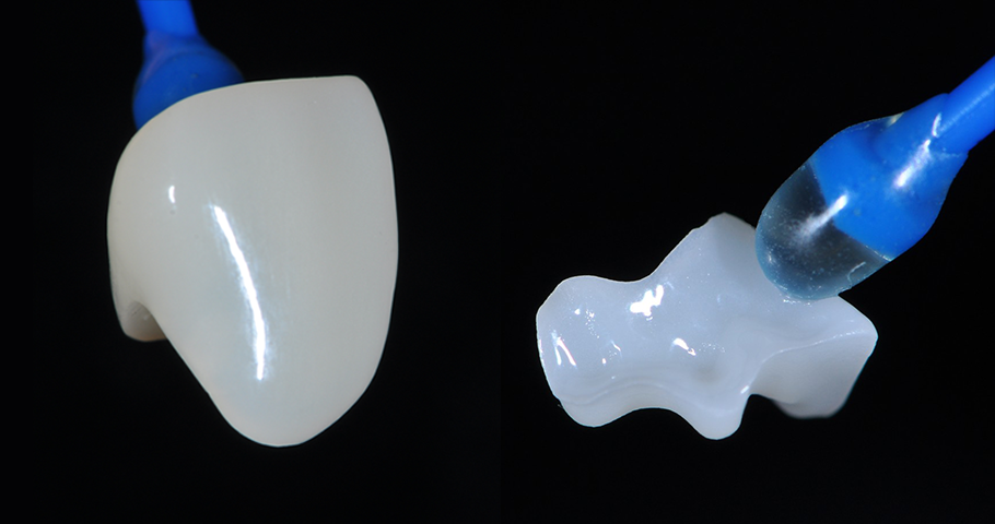 HASS to Launch 'Dry-Millable Lithium Disilicate' in Korea This July