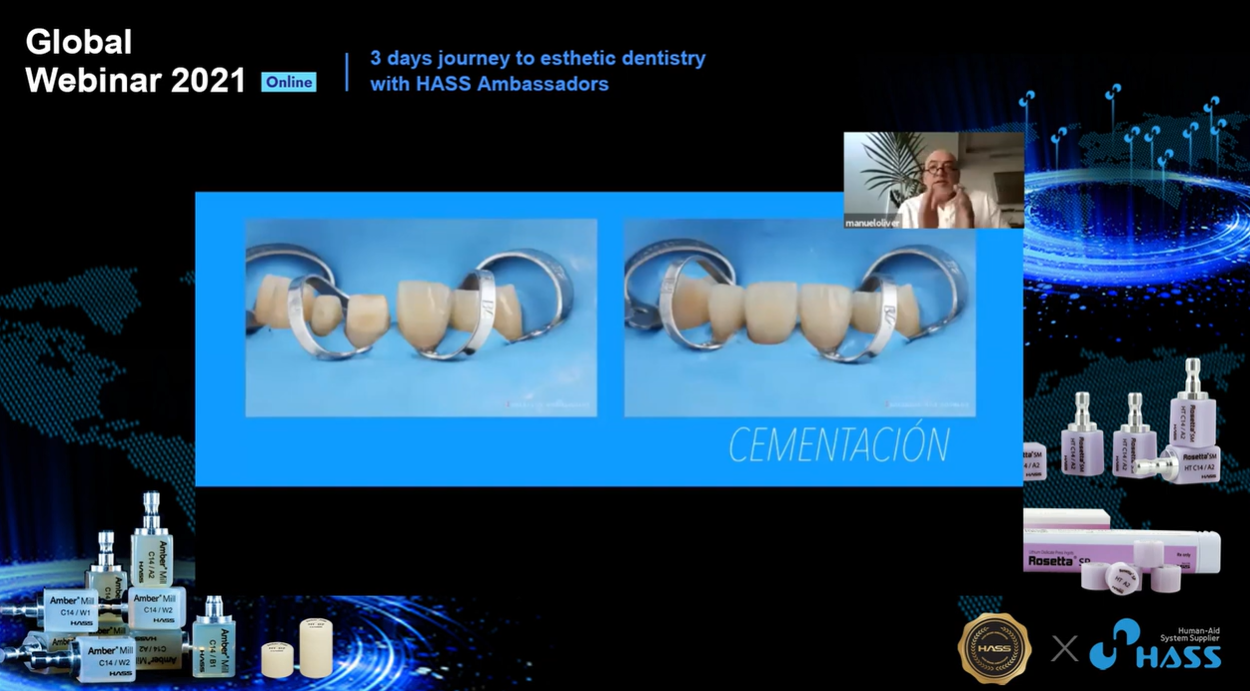 [AP-Webinar] Casos Clinicos con disilicato de litio