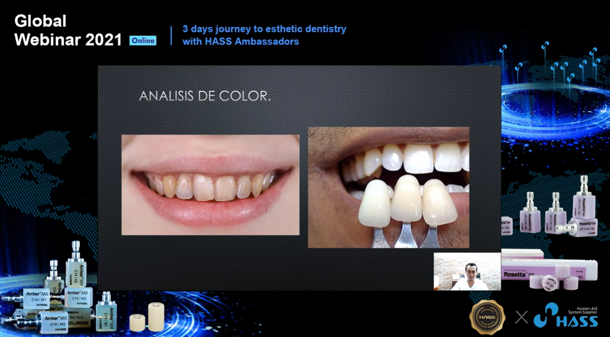 [Rosetta SP-Webinar] Lo Facil De lo Natural
