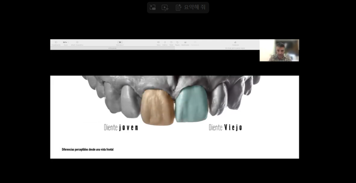 [AM-Webinar] Control Seccional De La Opacidad Con Amber Mill