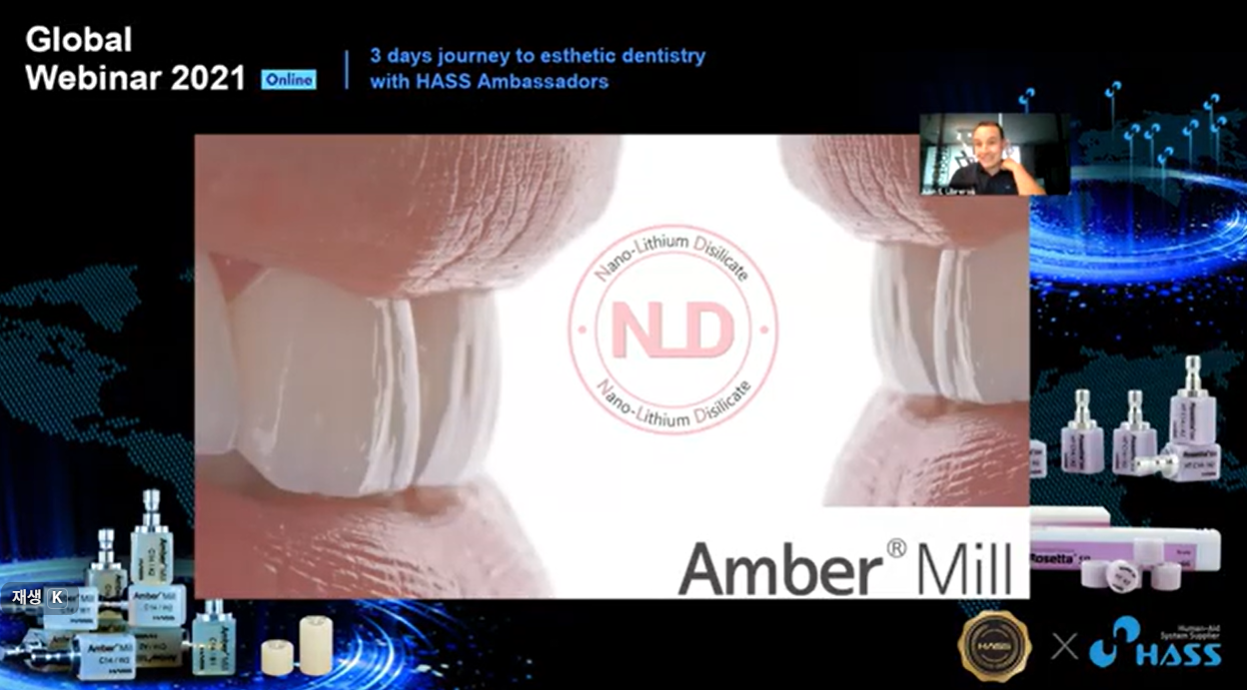 [AM-Webinar] Inoffice Veneers Inside the Lab
