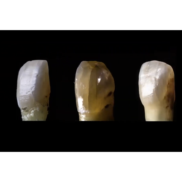 Control Seccional De La Opacidad Con Amber Mill