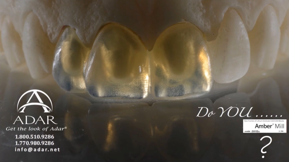 [AM-Manual] 3 unit Monolithic Anterior Bridge