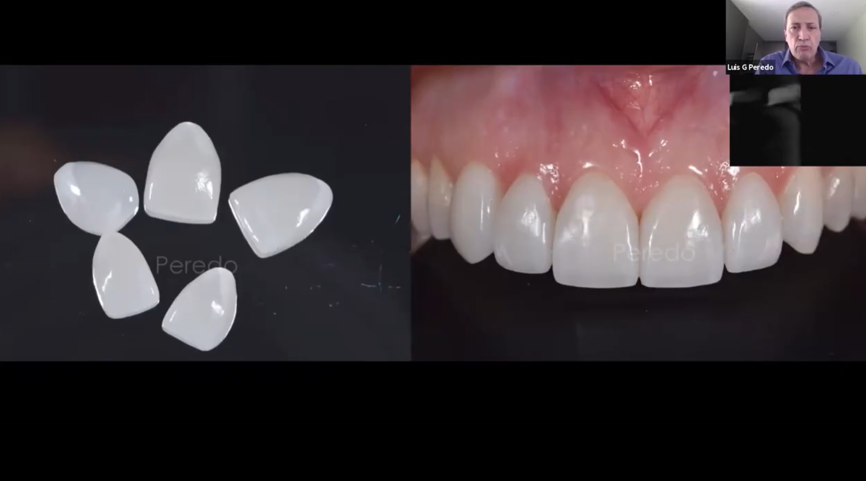 [AP-Webinar] Detalles clinicos para el exito extetico con Rosetta Y Amber Press