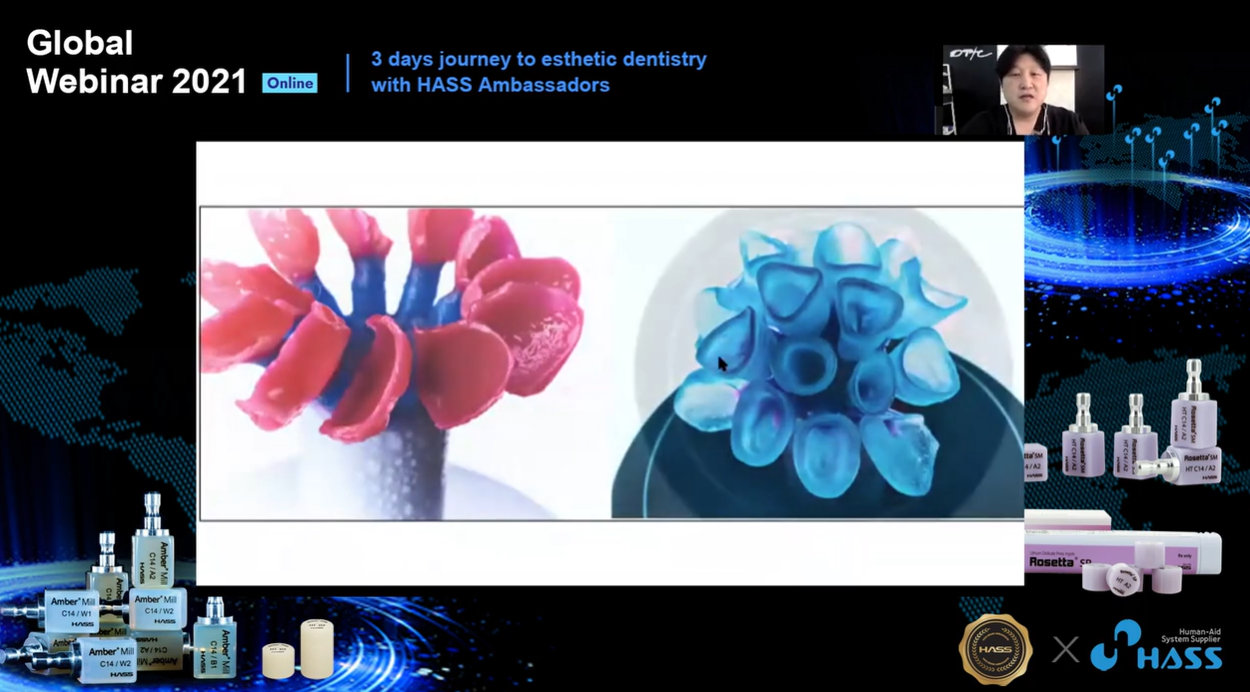 [AP-Webinar] 3D Printing & Press Veneers