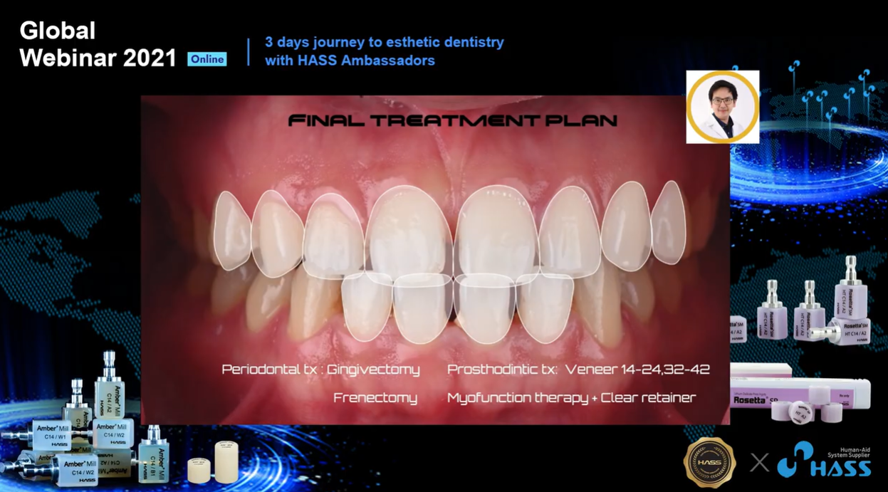 [AP-Webinar] Digital Planning and workflow in Esthetics Multidisipinary case wit