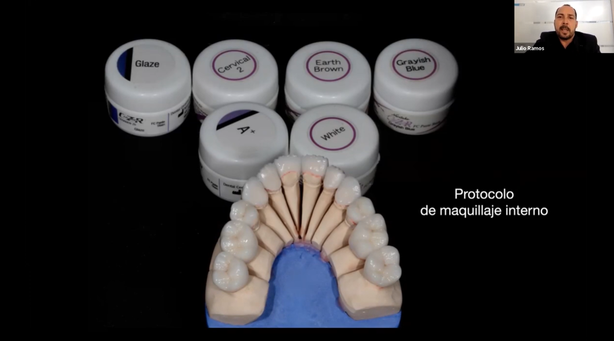 [AP-Webinar] Carillas con alto valor Amber Press