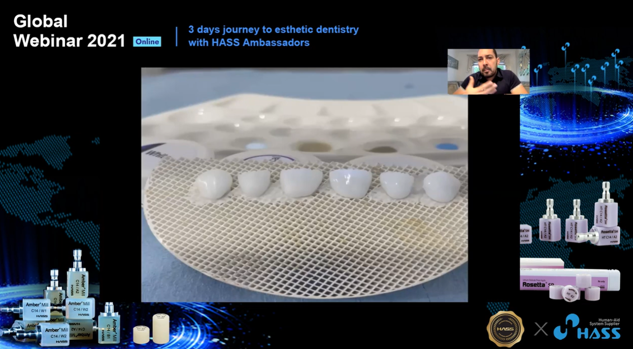 [AP-Webinar] Desarrollo Para Alta Estetica En Amber Press