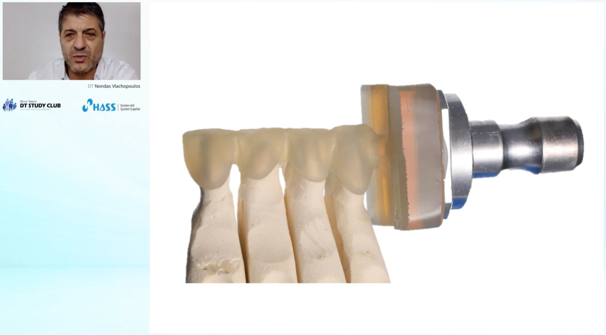 [APM-Webinar] Amberism - way to achieve aesthetic restorations with Amber Press